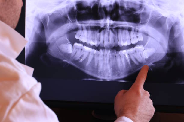 Best Emergency Denture Repair in Manahawkin, NJ